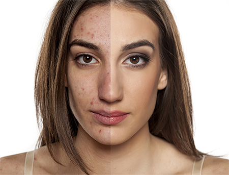 Not known Incorrect Statements About Medical Spa Los Angeles - Med Spa Redondo Beach  thumbnail