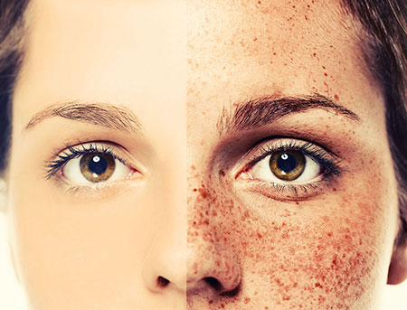 Face of Jules offers effective pigmentation treatment services.